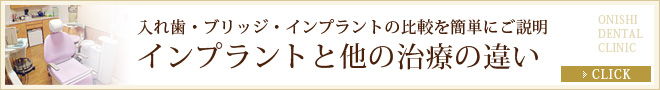 入れ歯・ブリッジ・インプラントの比較を簡単にご説明 インプラントと他の治療の違い